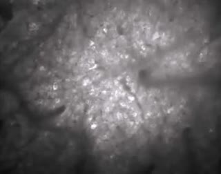 Microscope view of neurons lit by a calcium-sensitive fluorescent protein