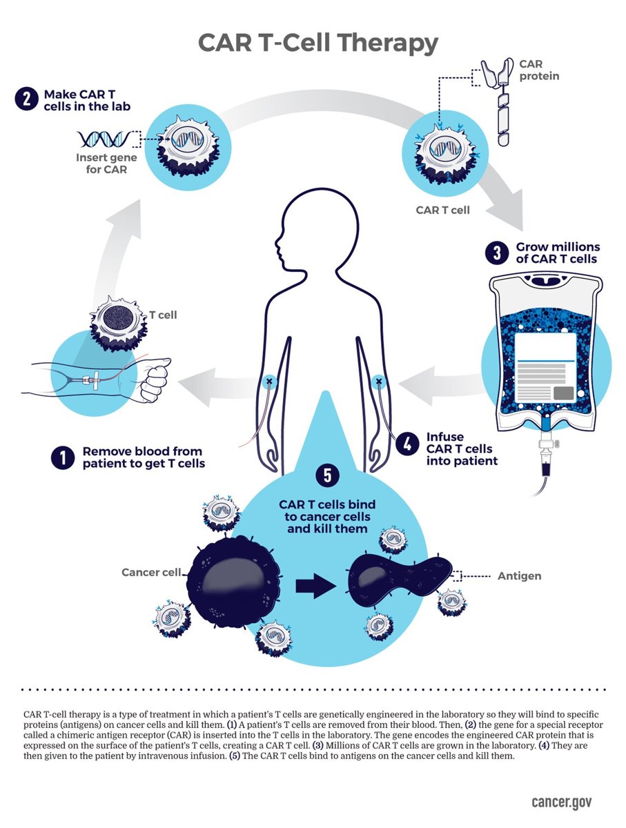 Diagram of CAR T-cell therapy
