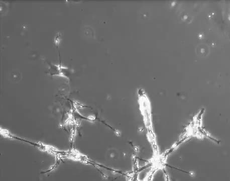 Bright branching neurons growing in a microscope view