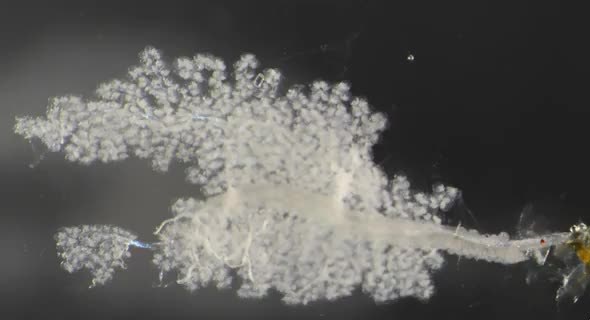 A pale branching microscopic structure on a dark background.